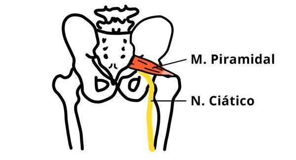 ejercicios para el sindrome piramidal