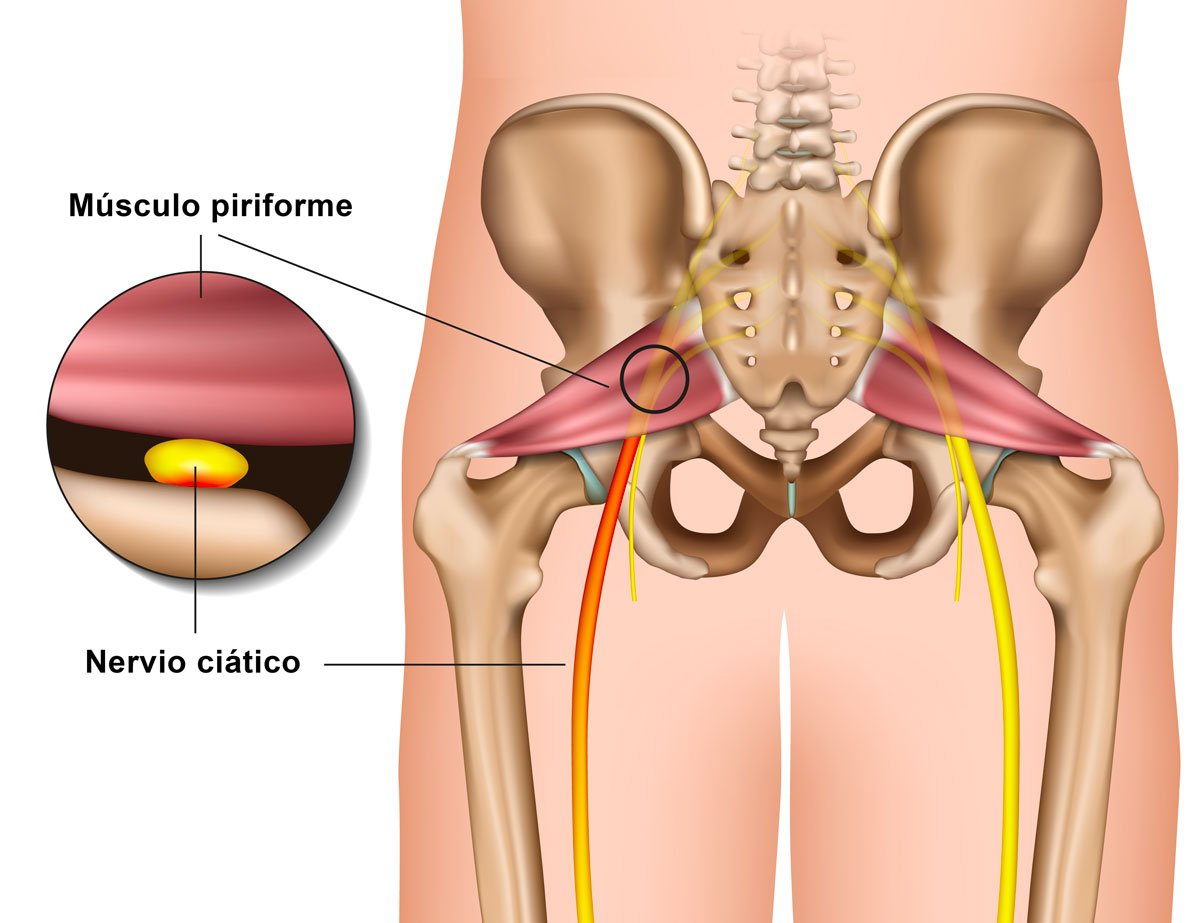 Trayecto del nervio ciático y músculo piriforme