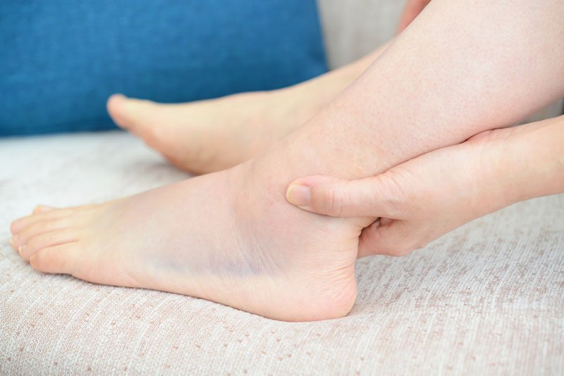 Esguince de tobillo e hinchazon